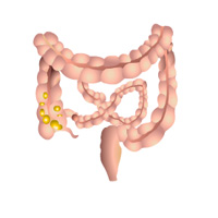 Crohn`s Disease: Diagnosis Certification Training