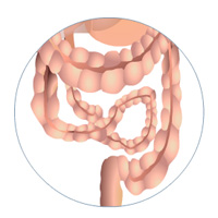 Crohn`s Disease: Treatment Certification Training